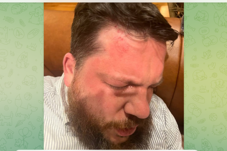 Alexey Navalny Yolsuzlukla Mücadele Vakfı'nın eski başkanı saldırıya uğradı