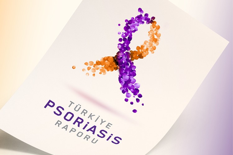 Ekonomik yük 46 milyar TL