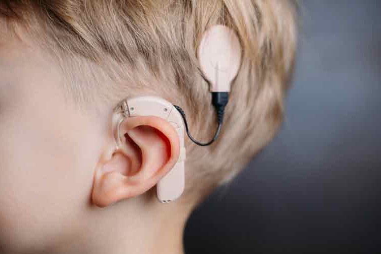 Cochlear "Takım Ruhu Ödülü"nü kazandı