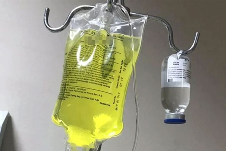 Sağlık Bakanlığından "sarı serum" açıklaması