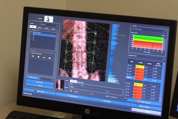 Osteoporoz polikliniğinde araştırılıyor