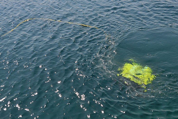 Yerli robotla müdahale