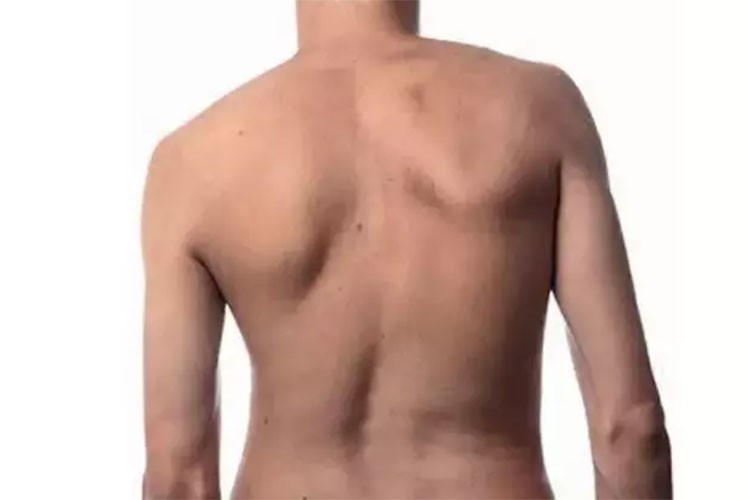 Z kuşağında omurga sorunları değerlendirmesi