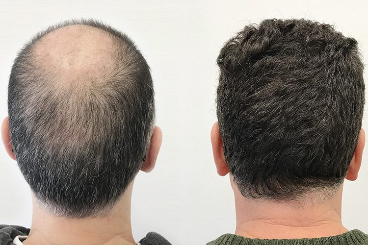 1 milyar doları geçti