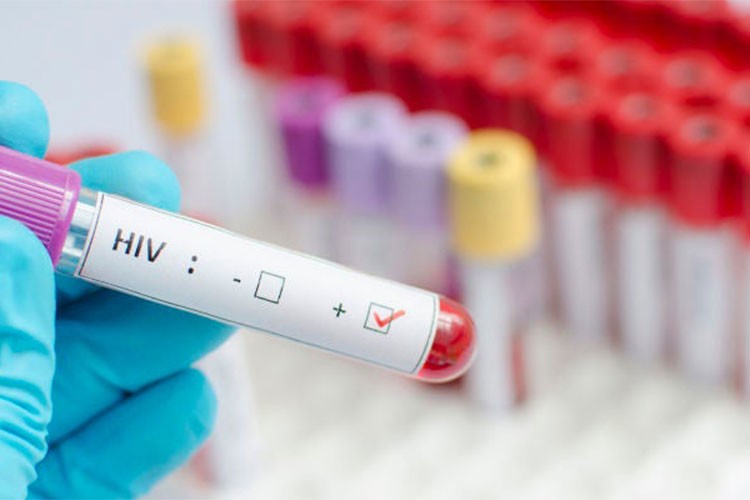 HIV/AIDS'e yönelik Gönüllü Test Merkezlerinin sayısı 10'a ulaşıyor
