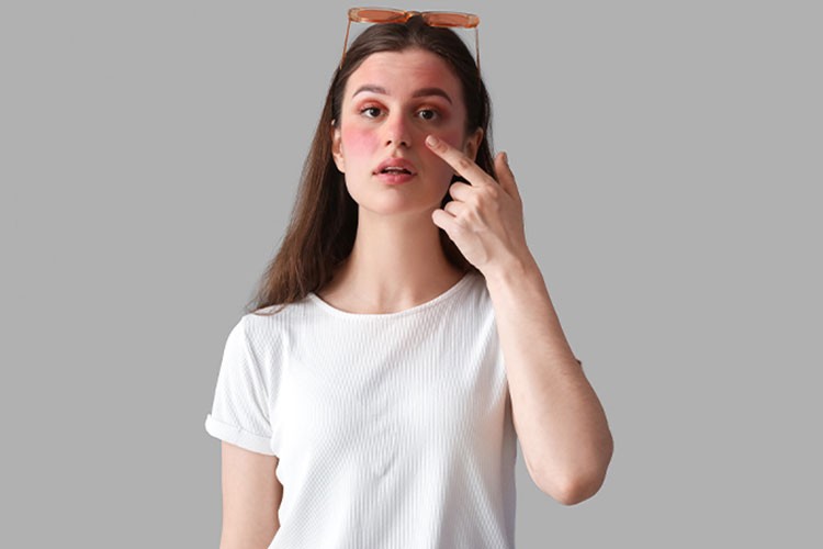 Güneşe çıkamama hastalığının gündelik hayata etkileri