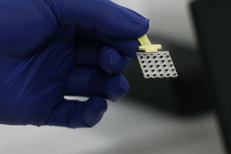 150 dolarlık elektrotlar yerli teknolojiyle 35 dolara üretiliyor