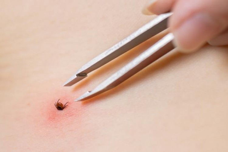 Giresun'da KKKA tedavisi gören kişi hayatını kaybetti