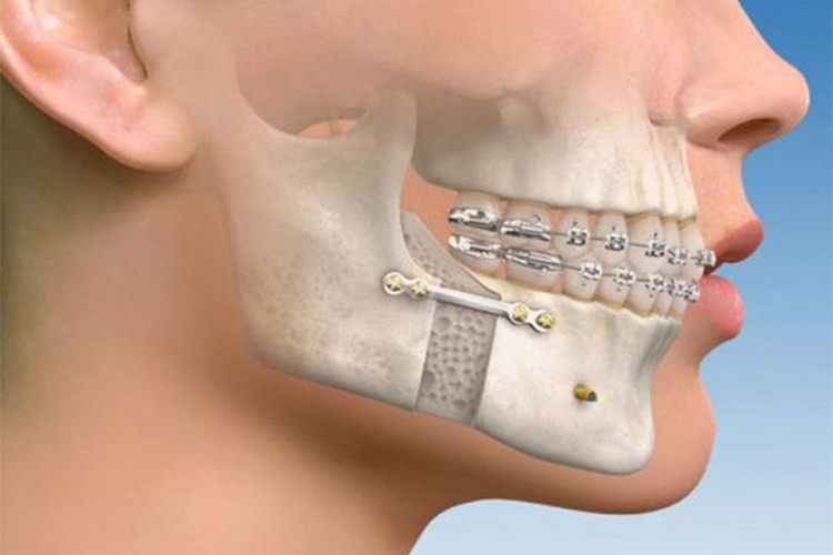 Yüzde 60'tan fazla estetik iyileşme sağlanabiliyor