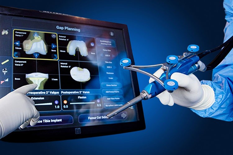 Robotik Diz ve Kalça Protezinin Avantajları