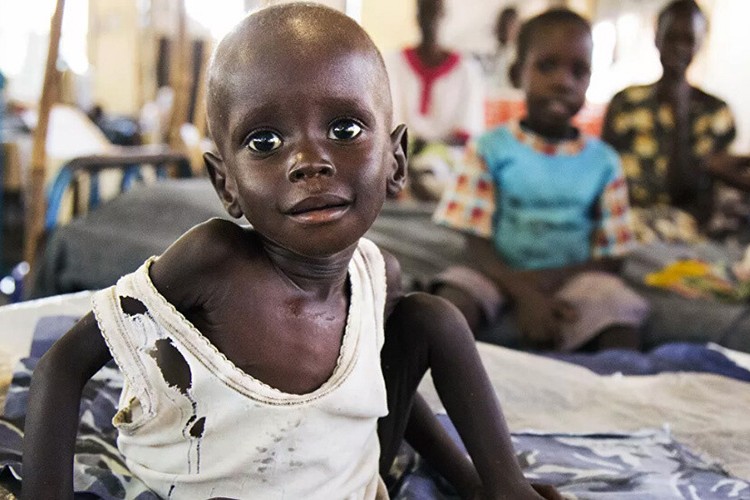 BM: 18 bölgede açlık daha kötüye gidecek