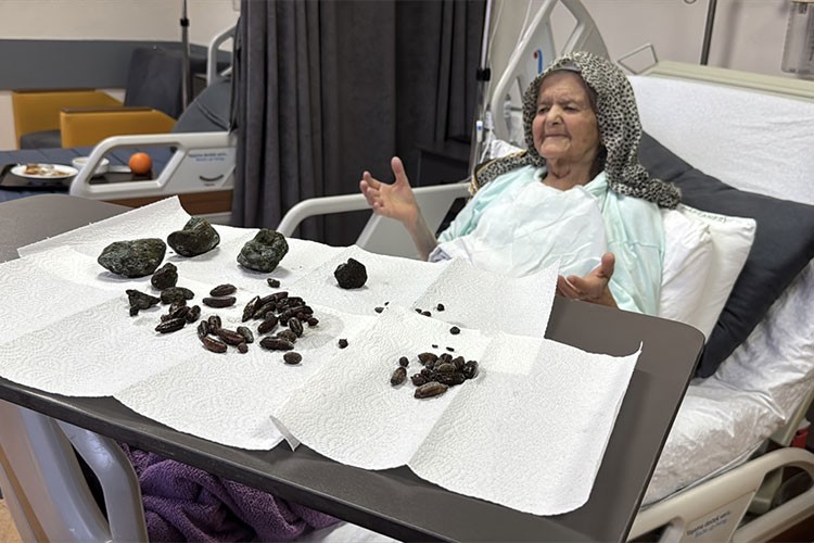 Yuttuğu zeytin ve hurma çekirdekleri nedeniyle ameliyat edildi