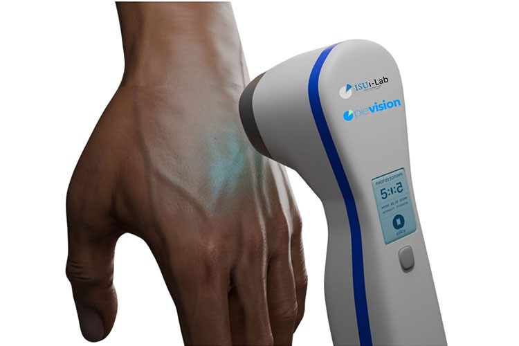 Vitiligo tedavisi için cihaz geliştirildi