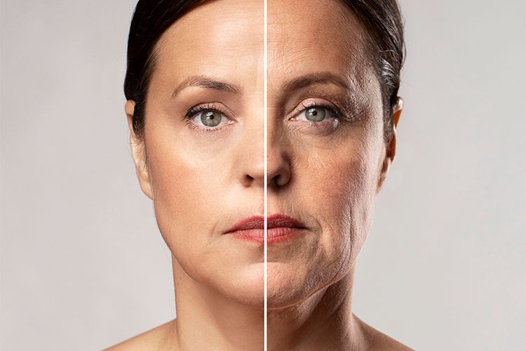 Derin Plan Yüz Germe ile Kalıcı ve Doğal Gençleşme